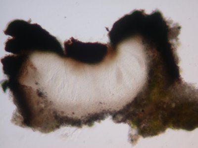 [Polysporina cyclocarpa]